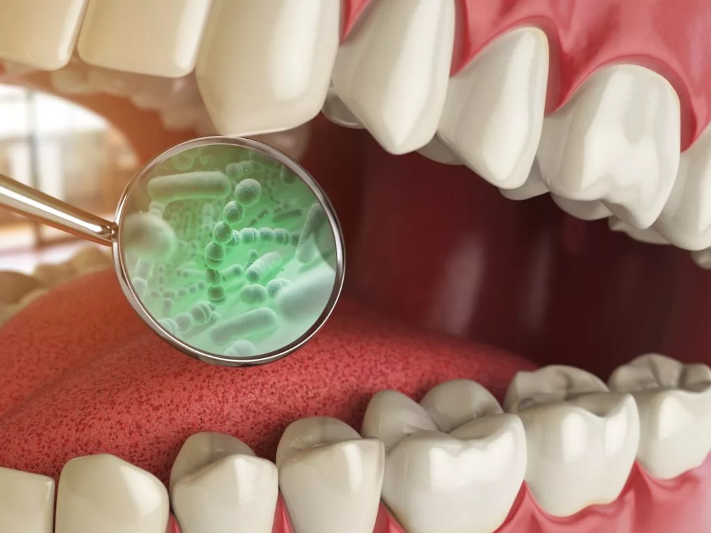 graphic of a mouth with a dental mirror showing germs