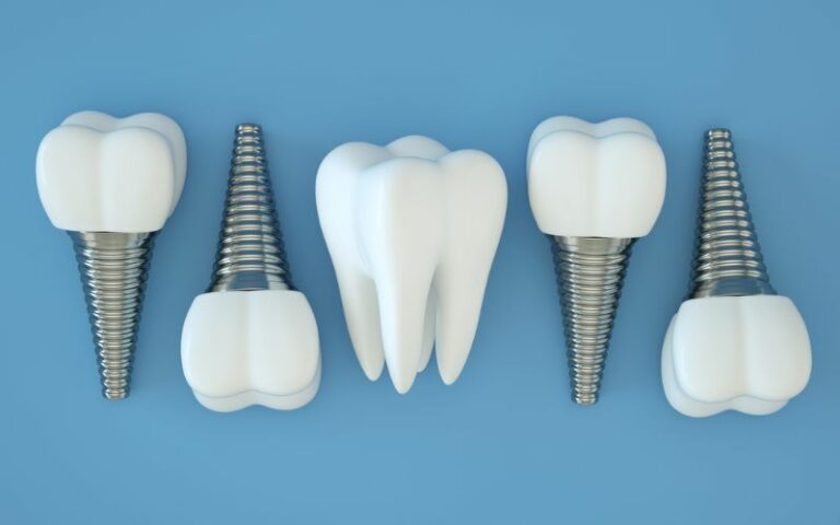 image of four dental implants on a blue background